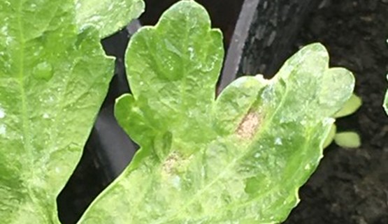 Physiological and cultural disorders